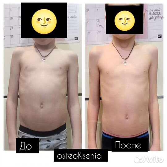 Оздоровление