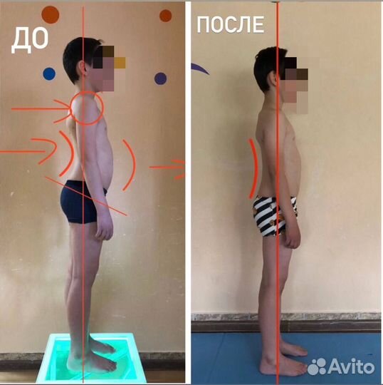 Инструктор лфк (вальгус, плоскостопие, сутулость)