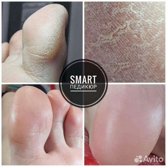 Маникюр, педикюр