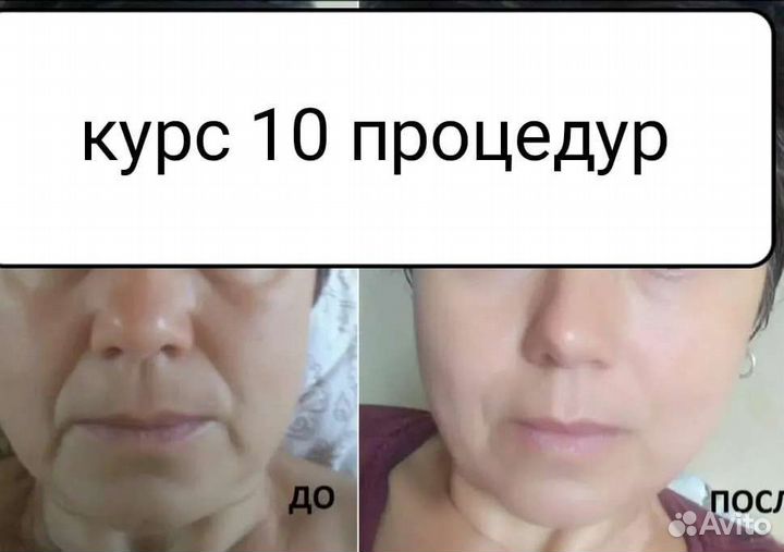 Маска для лица