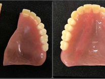 Ремонт съёмных Зубных протезов