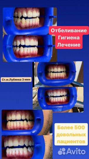 Подарочный сертификат на стоматологические услуги