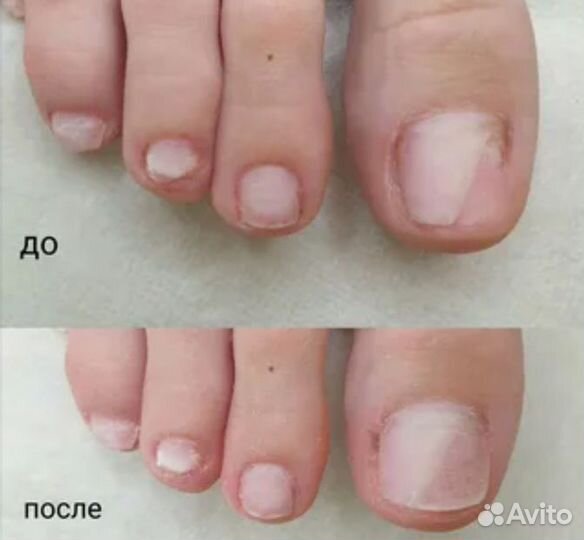 Маникюр педикюр на дому