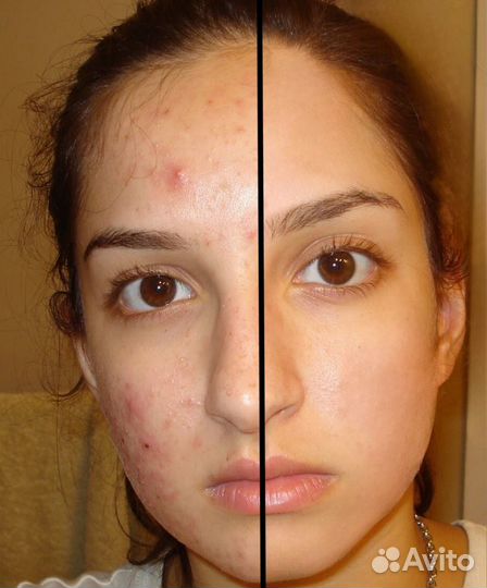 Обработка фотографий ретушь фотошоп