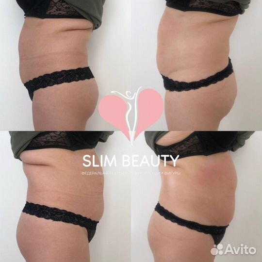 Похудеть до 10 кг за курс