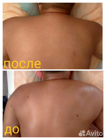 Оздоровительный и Антицеллюлитный массаж