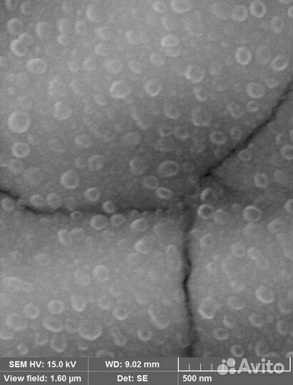 Электронная микроскопия (сэм)