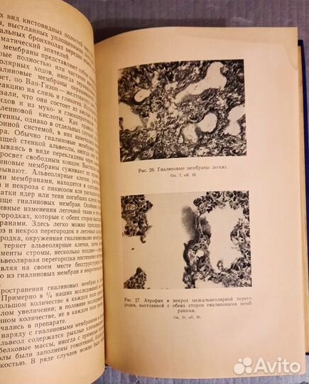 Гипоксия плода и новорожденного.Патогенез и диагн