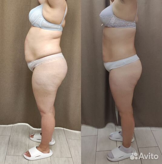 Модель на аппаратный массаж