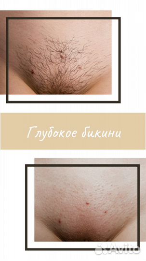 Шугаринг (выезд на дом).Мужчинам не беспокоить