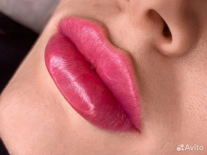 Моделирование губ увеличение