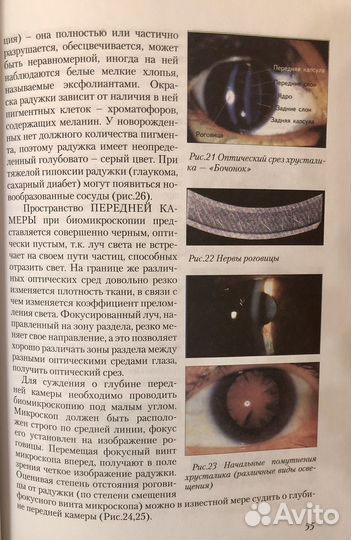 Оптометрия для начинающих оптометристов