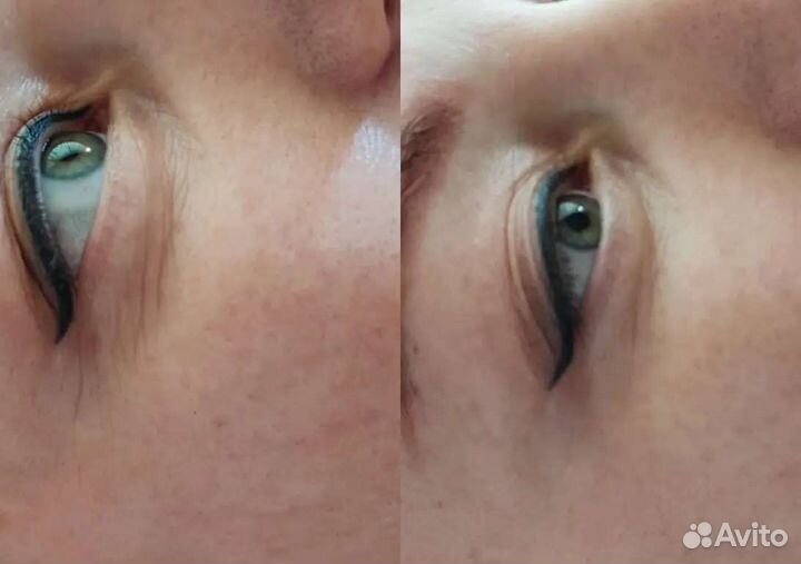 Маска для лица