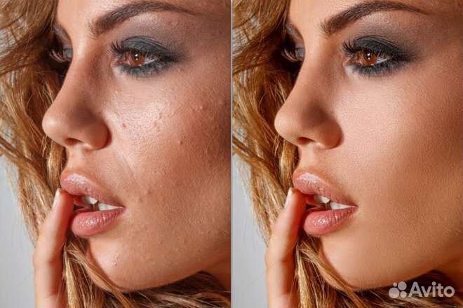 Ретушь фото. Обработка. Восстановление фотографий