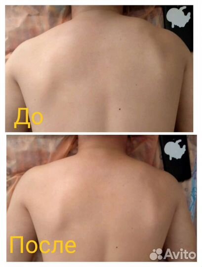 Оздоровительный и Антицеллюлитный массаж