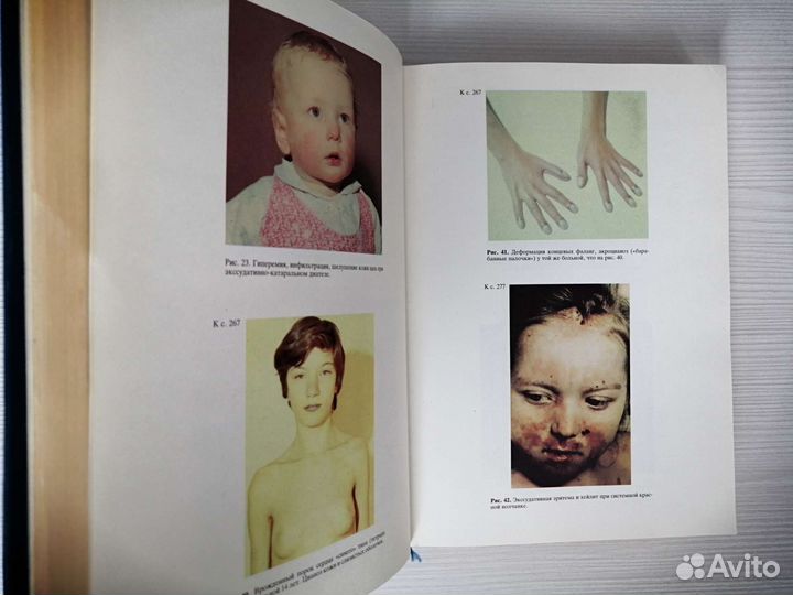 Детские болезни (1994г.) / Л. Исаева