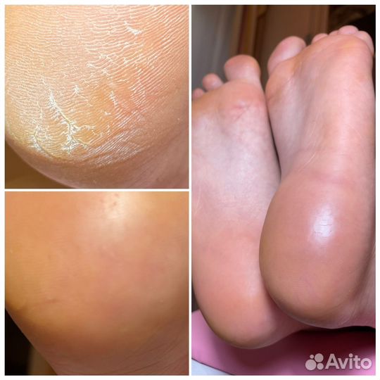 Модели на маникюр и педикюр, наращивание