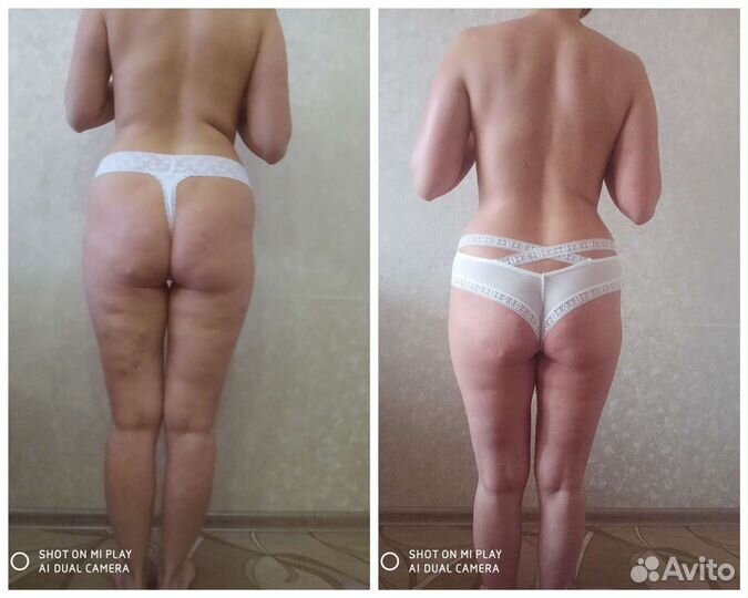 Коррекция фигуры и лица