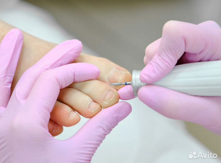 Курс аппаратного педикюра онлайн