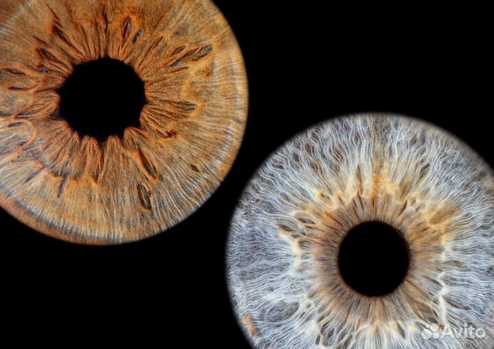 Фото радужки глаз 