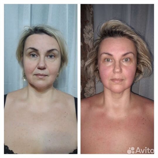 Массаж на дому (диафрагмы тела-тазовое дно)