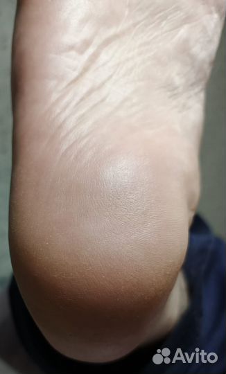 Маникюр, педикюр на дому