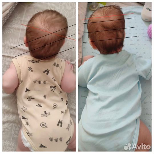 Детский массаж и ЛФК