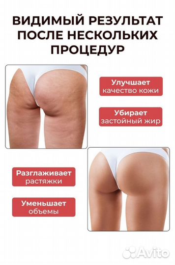 Антицеллюлитный массажер
