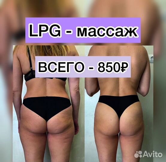 LPG массаж. Коррекция фигуры. Похудение