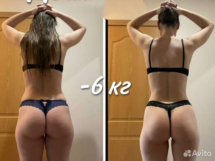 Антицеллюлитный массаж