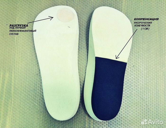 Изготовление индивидуальных стелек