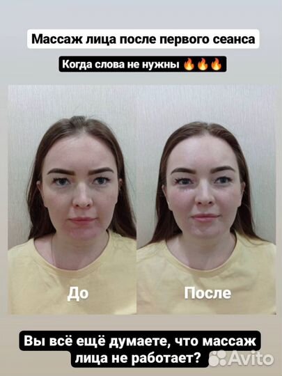 Буккальный массаж лица