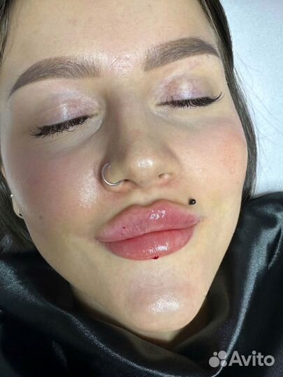 Контурная пластика губ