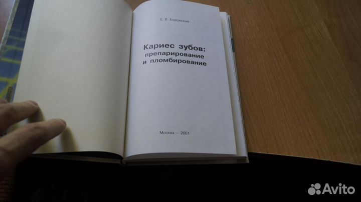 Кариес зубов:препарирование и пломбирование. М ао