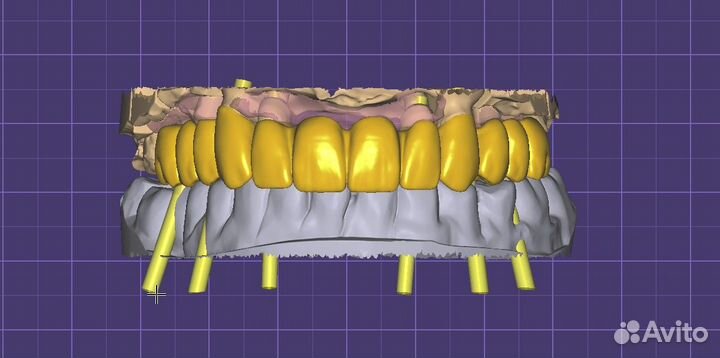 Зубной техник cad Cam