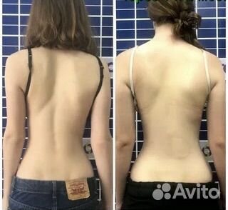 Вытяжка позвоночника, массаж