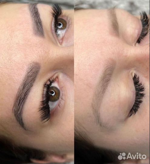 Удаление татуажа