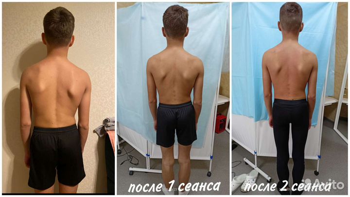 Мануальный массаж Анапа