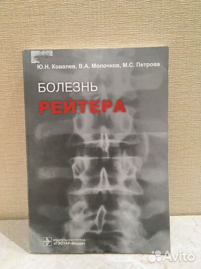 Болезнь Рейтера