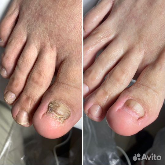 Подолог, смарт педикюр, маникюр