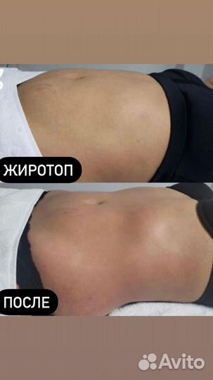 Коррекция фигуры и spa