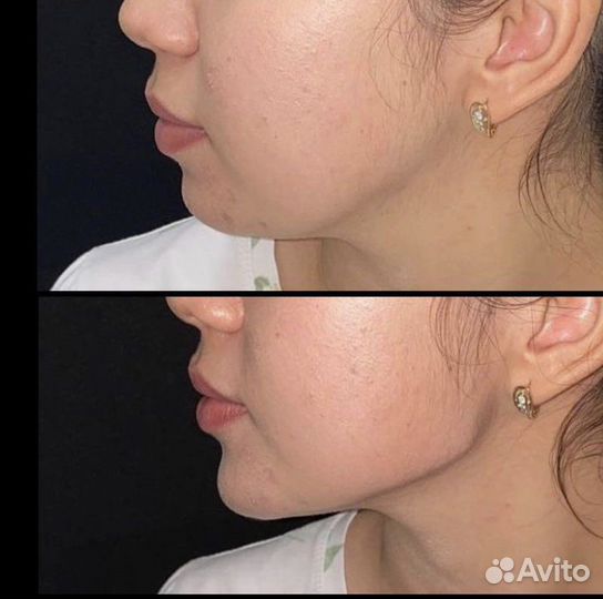 Врач косметолог