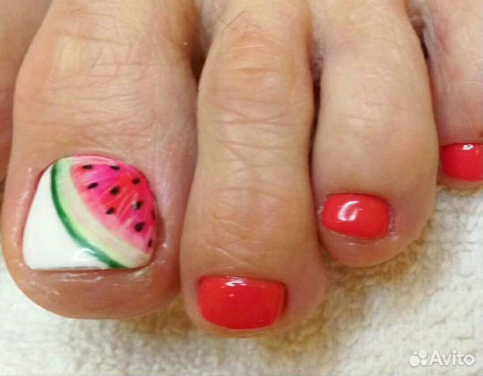 Вросший ноготь Онихолизис Титановая нить Подолог