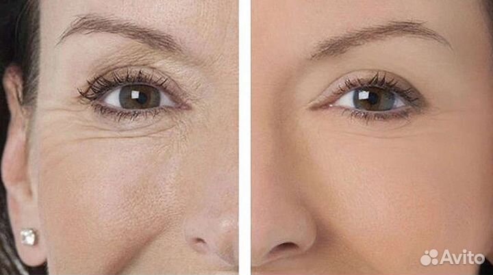 Услуги косметолога