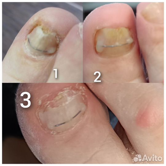 Услуги подолога