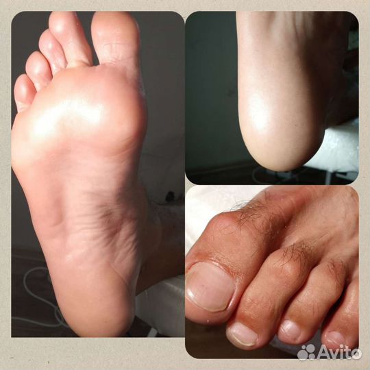Педикюр сормово