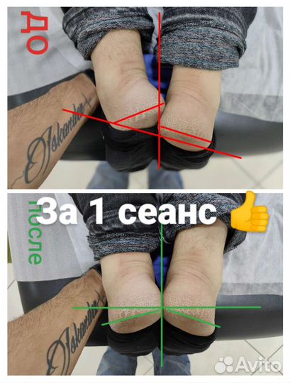 Массажист Костоправ Реабилитолог