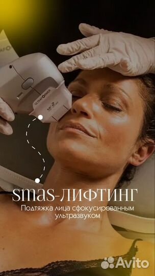 СМАС лифтинг