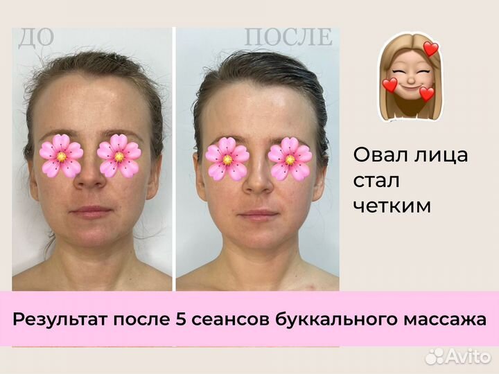 Массаж на дому