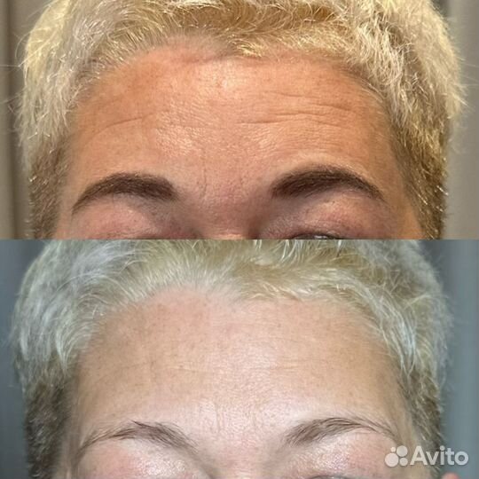 Омолаживающий массаж лица